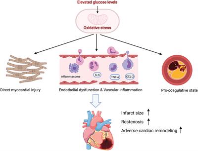 Stress Induced Hyperglycemia in the Context of Acute Coronary Syndrome: Definitions, Interventions, and Underlying Mechanisms